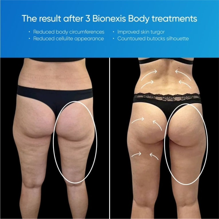 Zemits Bionexis Lite Pro Kontürleme Sistemi